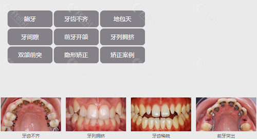 宁波牙博士口腔牙齿矫正