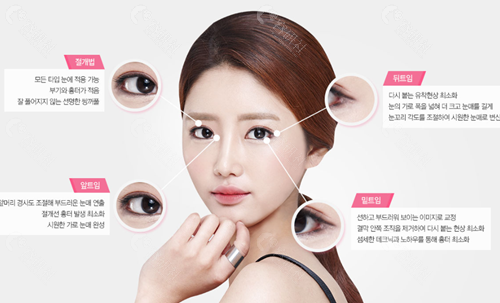 韩国必当归医院双眼皮手术
