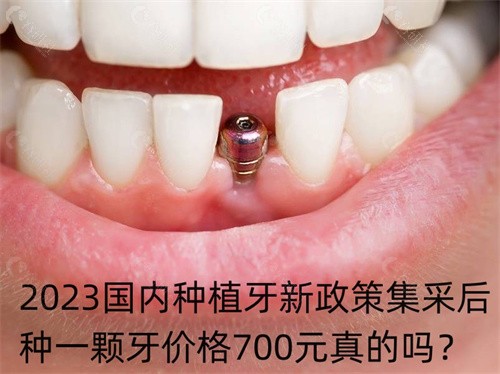 2023国内种植牙新政策集采后种一颗牙价格700元真的吗？