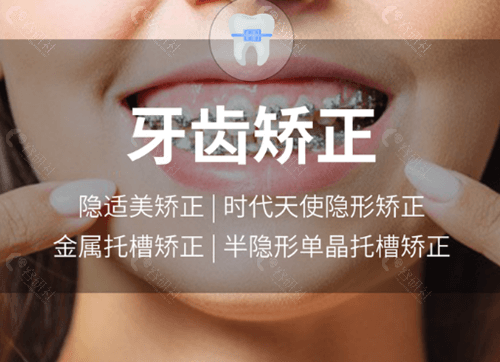 南京固德口腔牙齿矫正项目