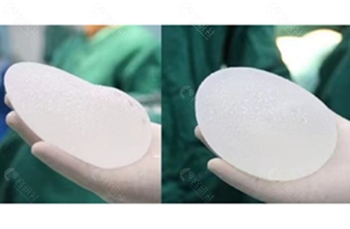 重庆华美整形医院乳房假体