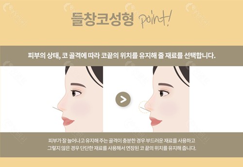 韩国格瑞丝噢爱美整形外科鼻修复技术介绍