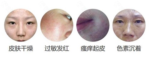 西宁夏都激光祛斑价格