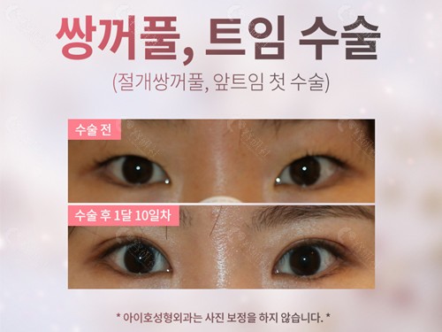 韩国爱护眼修复照片