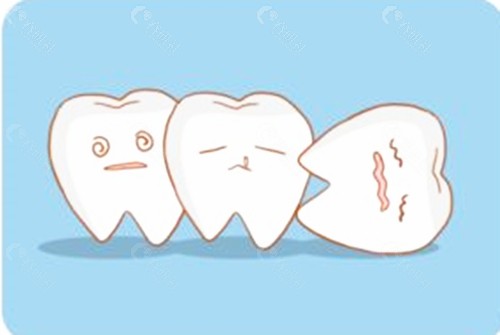 补牙材料贵的和便宜的有什么区别？