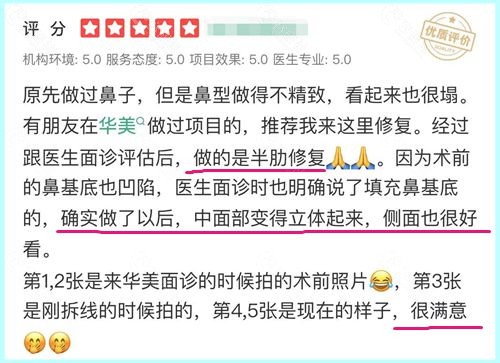 重庆华美李超修复鼻子怎么样？看顾客口碑评价