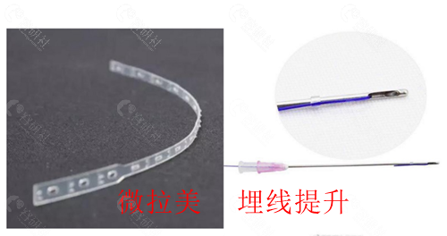 微拉美3.0和埋线提升相比哪个维持时间更长？