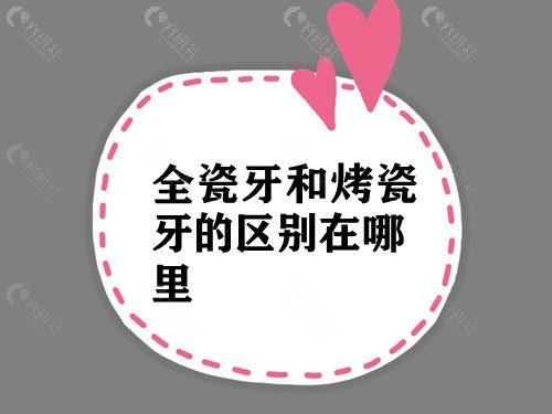 全瓷牙和烤瓷牙的区别在哪里