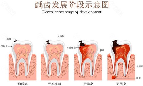 牙龈很鼓很硬像骨头一样怎么回事