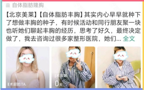 北京美莱自体脂肪丰胸