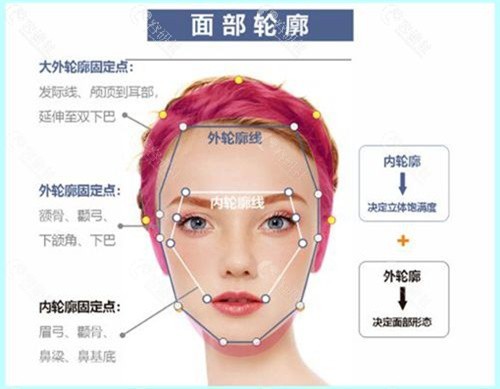 医院做轮廓固定有哪些方法