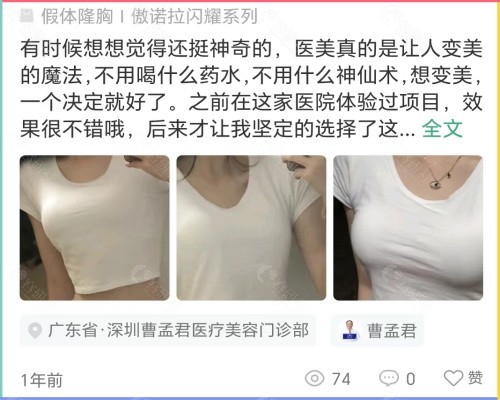 深圳曹孟君隆胸怎么样