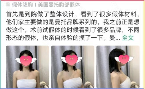 美莱隆胸医生技术好不好