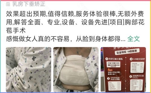 深圳南雅医疗美容做胸怎么样