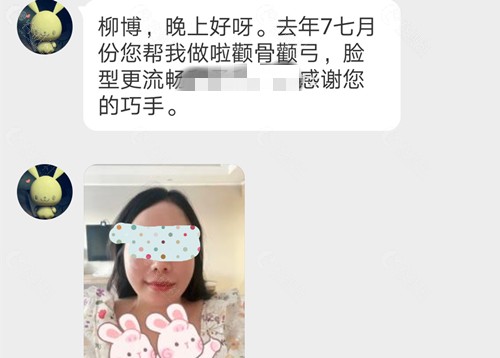 广东韩妃柳超改脸型术后评价