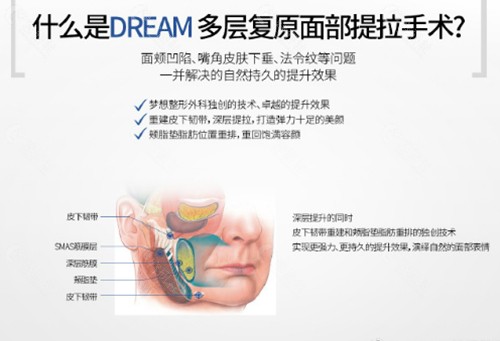 韩国梦想拉皮手术优势介绍