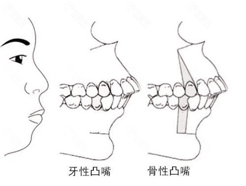 手术矫正的具体手段有哪些