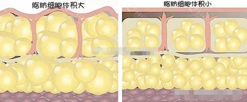 脂肪细胞大小的区别