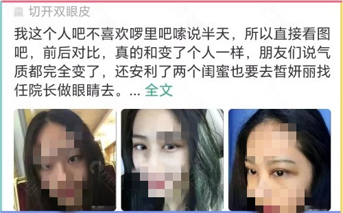 兰州皙妍丽双眼皮谁做得好