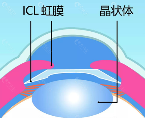 眼睛的构造