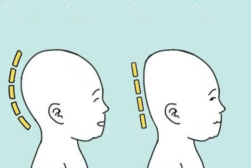 扁头填充手术多少钱？