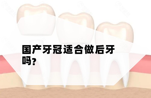 国产牙冠适合做后牙吗