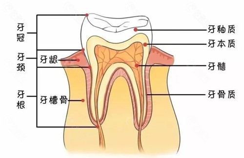 国产牙冠和进口牙冠有什么区别