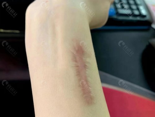 重庆骑士医院疤痕科口碑好吗