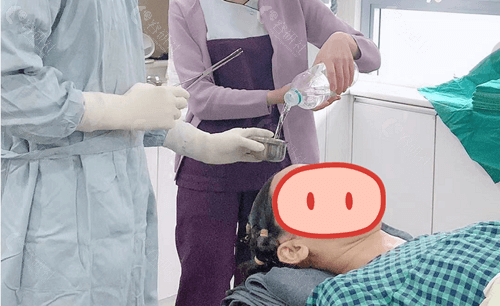 雕刻整形外科骨水泥填充进行中