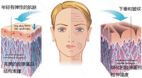 胶原蛋白针打多了会怎么样