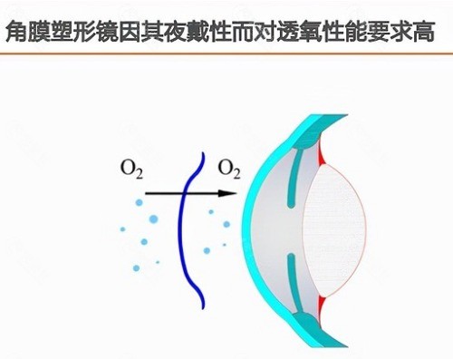 普诺瞳角膜塑形镜适用人群 