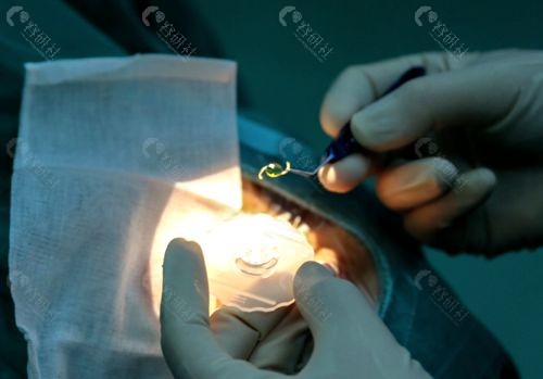 北京茗视光眼科医院三焦点人工晶体植入手术