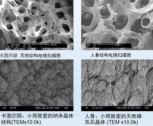 珊瑚骨填充眉骨移位的感觉是怎样的