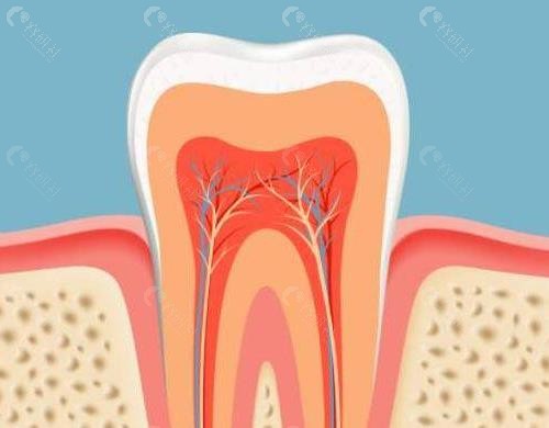 牙齿根管治疗图片