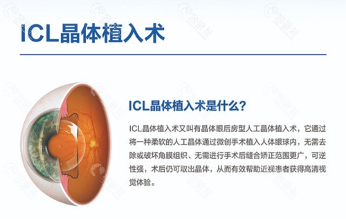 乌鲁木齐爱尔眼科医院挂号预约