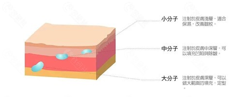 面部填充能保持多久