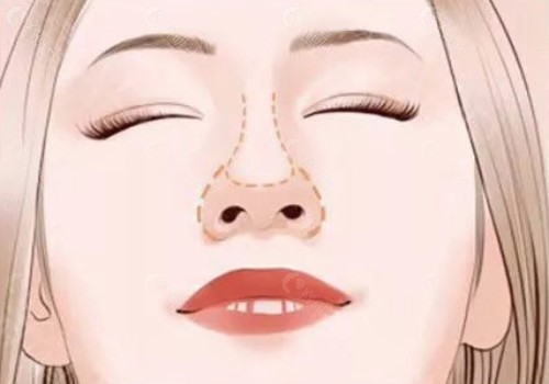 卡通美女鼻部图片