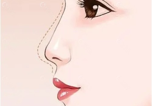 卡通美女鼻子轮廓图片