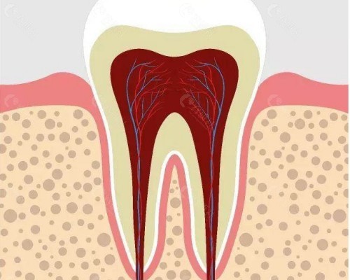 牙髓炎图片