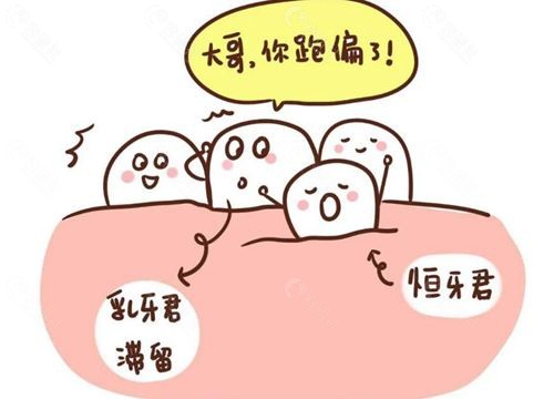 乳牙没脱落恒牙却冒出来怎么办