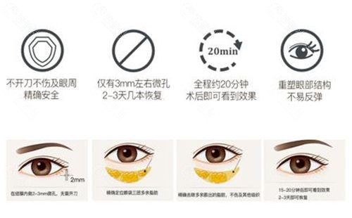 健丽医美不开刀去眼袋技术原理