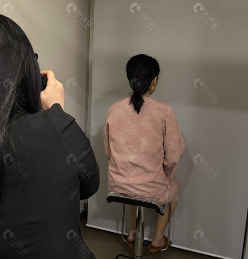 普罗菲耳整形外科医院耳垂再造术前拍照中