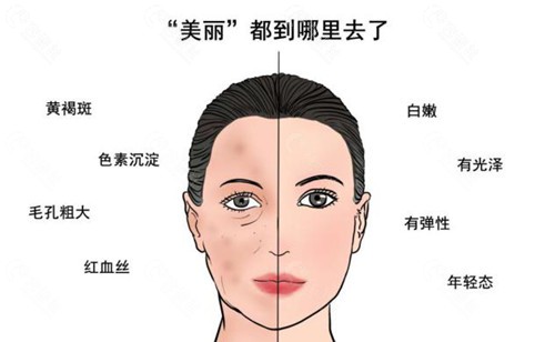 皮秒激光原理及成效