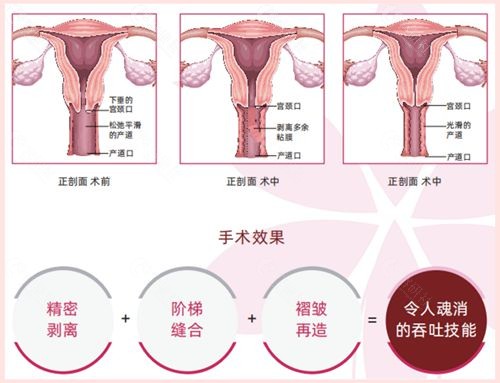 韩国好手艺女性整形医院子宫复位健康管理术技术优势