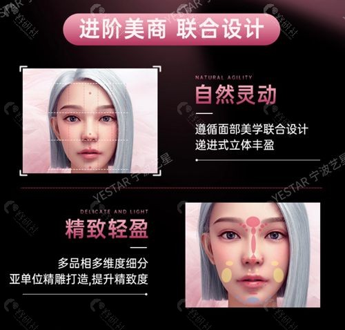 宁波艺星微整注射项目优势