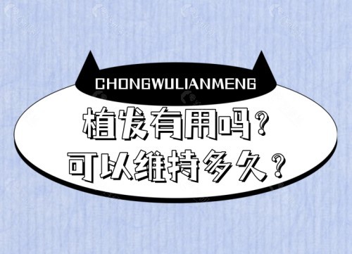 植发可以维持多久