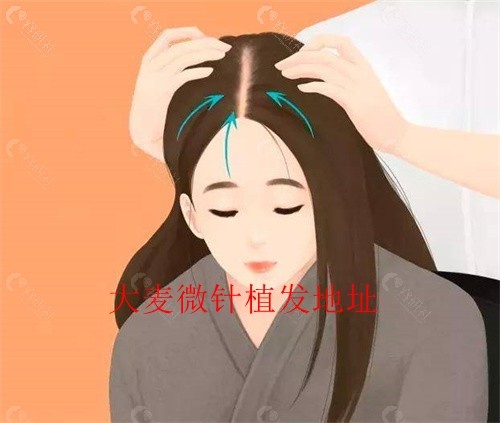 大麦微针植发地址