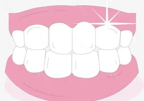大连牙齿美白多少钱？