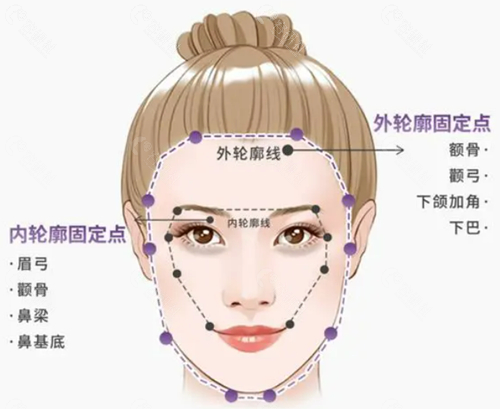 2024北京轮廓固定好的医生排名