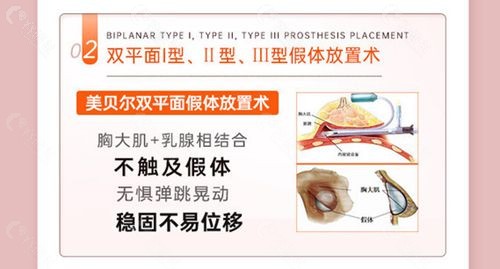 黄名斗隆胸方式